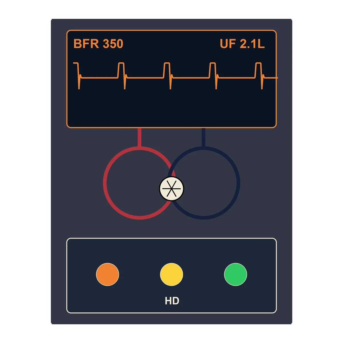 Hemodialysis Machine